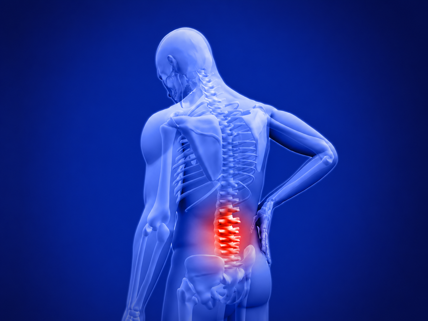 Chronic Back Pain — anatomical illustration