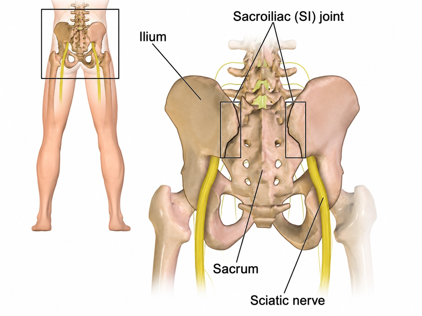 Sacroiliac Joint Pain — anatomical illustration