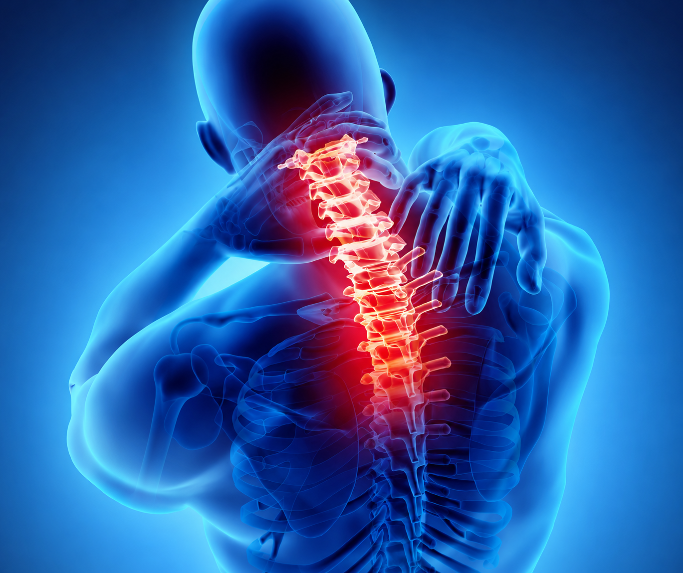 Neck Pain — illustration