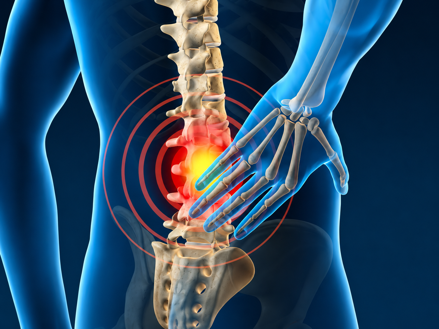 Recurring Disc Pain — illustration