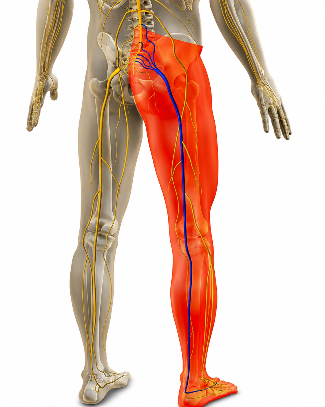 Sciatica / Leg Pain — illustration